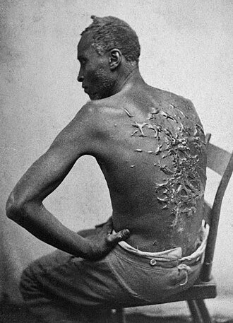 Whipped Peter, Baton Rouge, LA, April 2, 1863 (Wikipedia) Whipped Peter, Baton Rouge, LA, April 2, 1863 (Wikipedia)